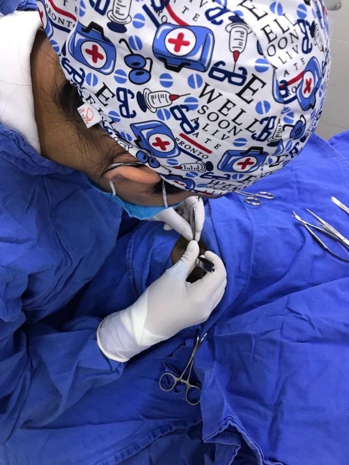 Suma IMSS Hidalgo a quinta donación de córneas en 2023