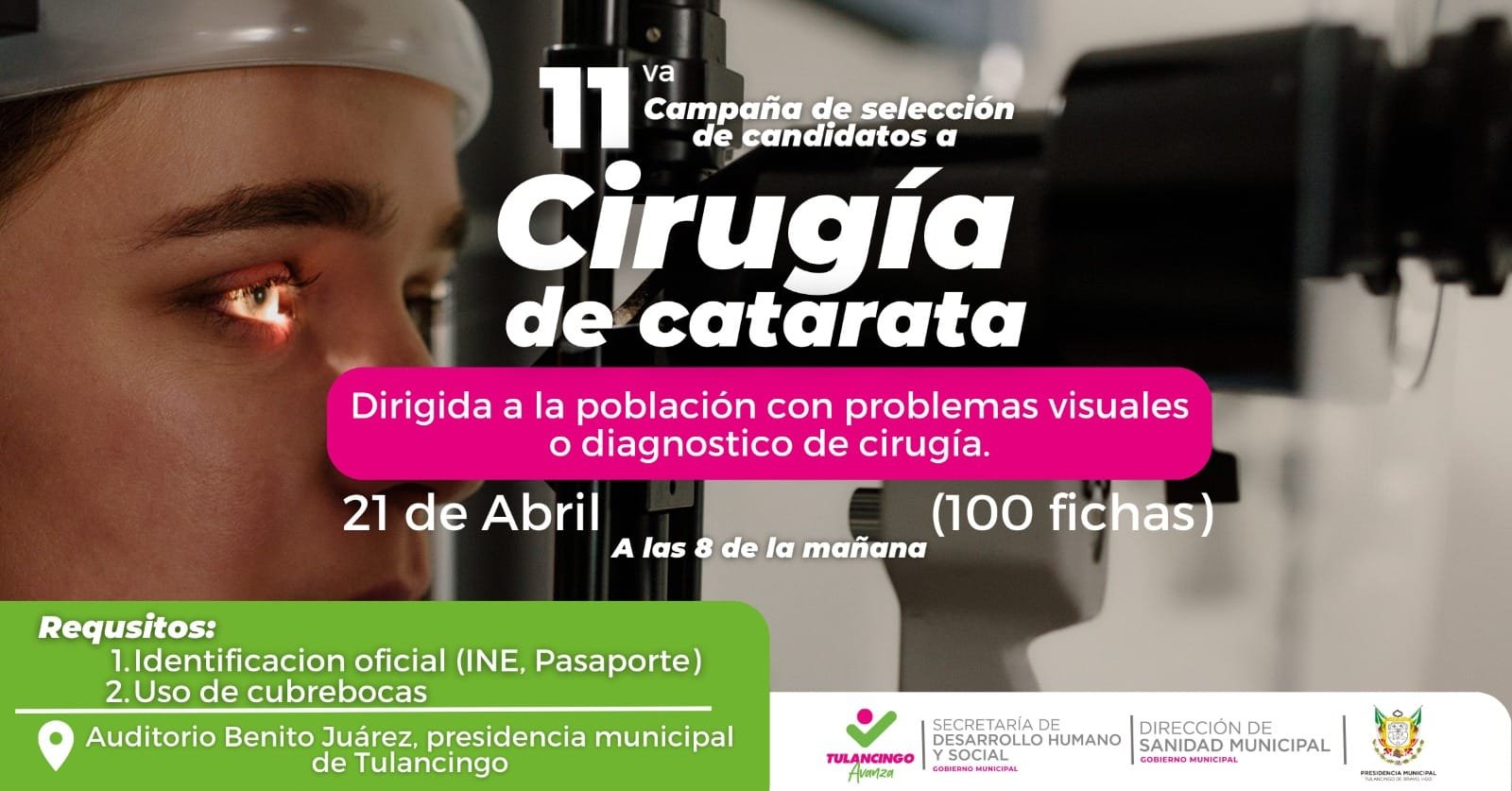Onceava Selección de Candidatos Para Cirugía de Cataratas en Tulancingo