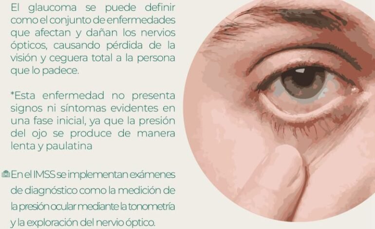 Crea Conciencia IMSS Hidalgo Sobre Padecimiento Visual de Glaucoma