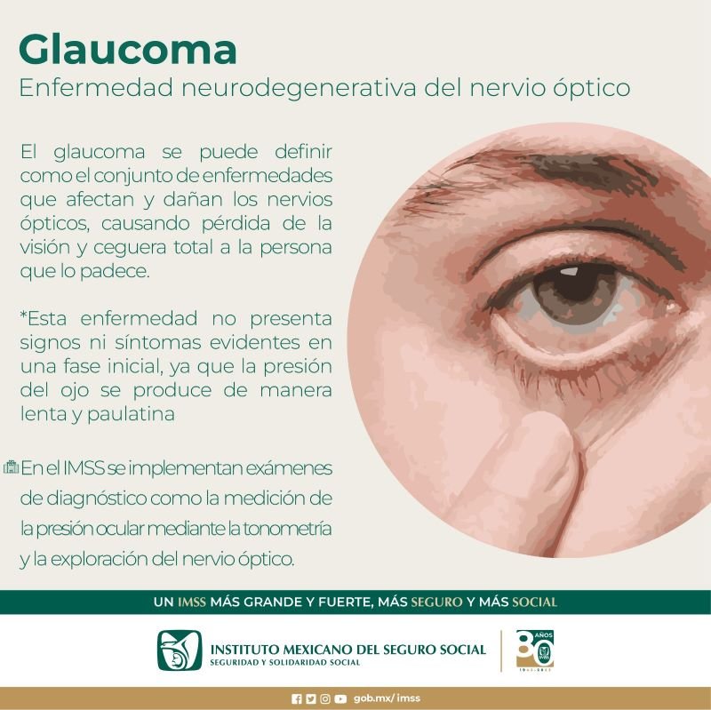 Crea Conciencia IMSS Hidalgo Sobre Padecimiento Visual de Glaucoma
