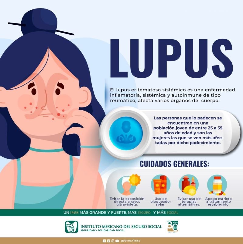 Recomienda IMSS Hidalgo Evitar Luz Solar Ante Presencia de Lupus