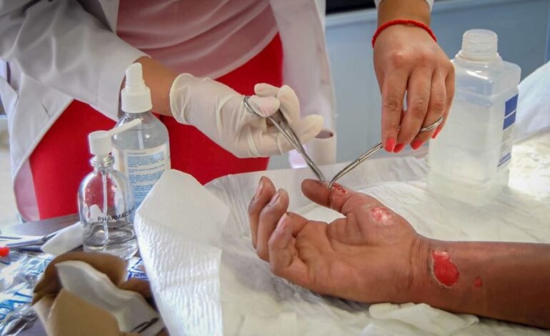 Emite SSH Recomendaciones Para Evitar Quemaduras Solares  Ante Altas Temperaturas