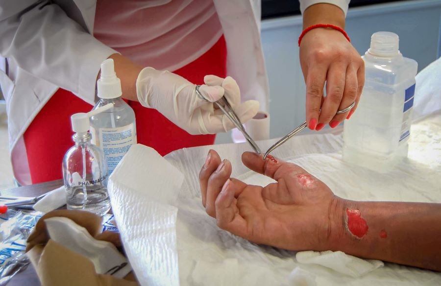 Emite SSH Recomendaciones Para Evitar Quemaduras Solares  Ante Altas Temperaturas