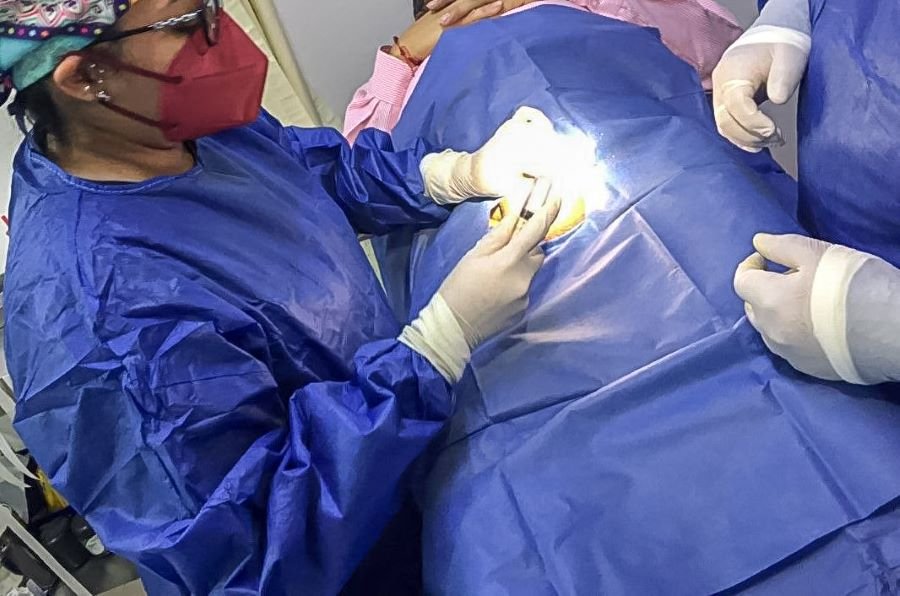 Promueve SSH Vasectomía Sin Bisturí Voluntaria y Gratuita