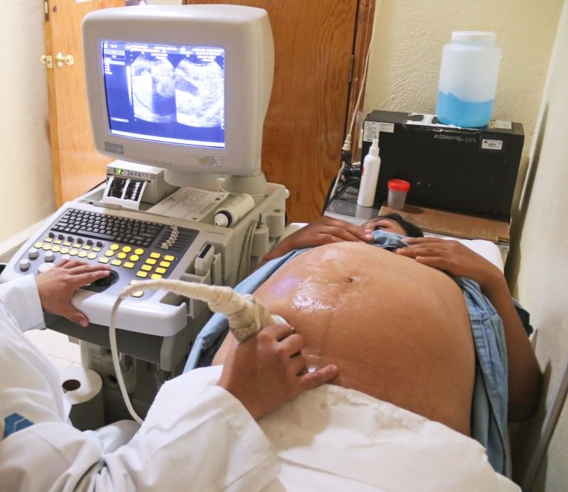 Embarazo Adolescente a la Baja en Hidalgo Desde 2017