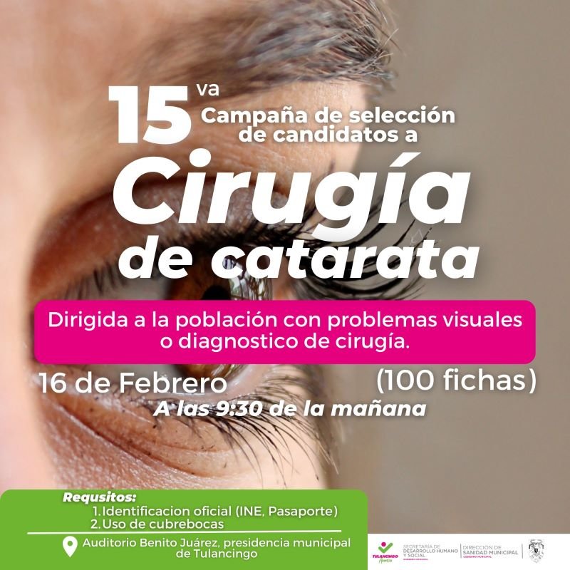 Este Viernes Filtro Selectivo de Candidatos a La Campaña de Cirugías de Cataratas en Tulancingo