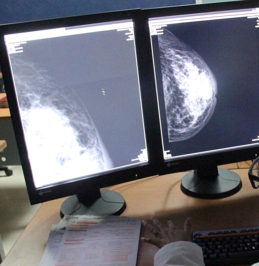 Hábitos saludables, Determinantes En La Proliferación De Todos Los Tipos De Cáncer: SSH