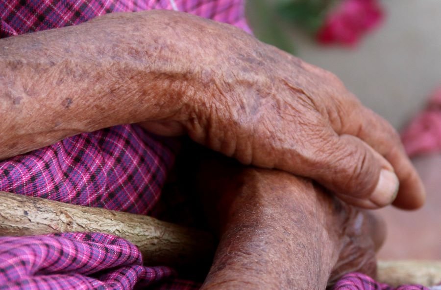 Recomienda SSH Prevenir Enfermedades Dermatológicas