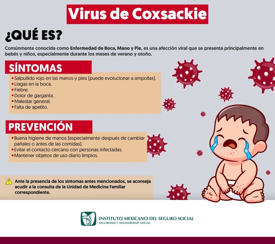 Previene IMSS Hidalgo de síntomas por Virus de Coxsackie