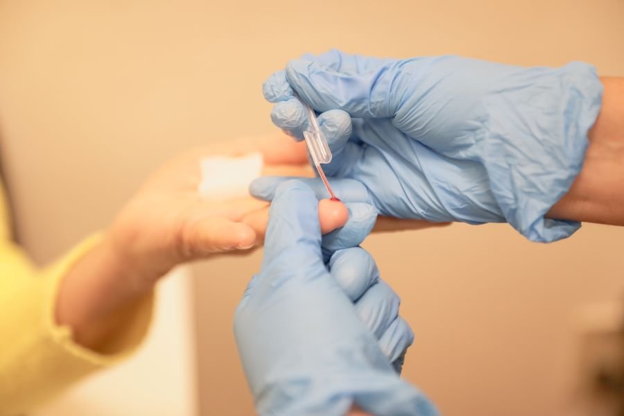 IMSS-Bienestar Hidalgo Ofrece Pruebas Gratuitas de VIH En El Primer Nivel de Atención