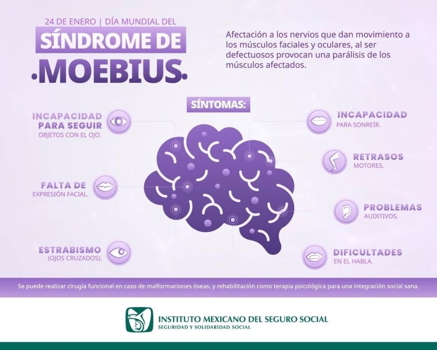 Promueve IMSS Hidalgo Atención Integral para Pacientes con Síndrome de Moebius