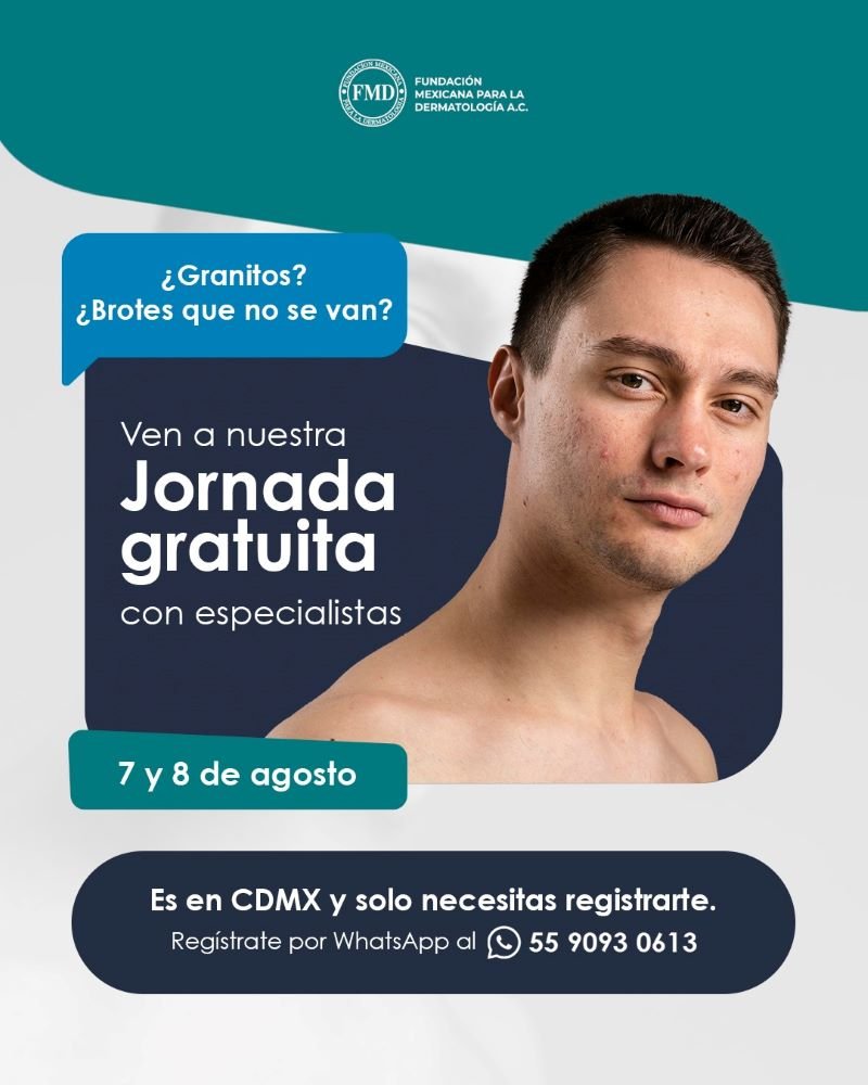 Jornada Gratuita de Atención a Personas Con Acné el 7 y 8 de Agosto en el Consultorio de la Fundación Mexicana Para la Dermatología