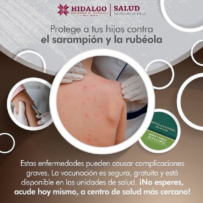 Cuidado Con el Sarampión, Enfermedad Contagiosa Que Se Propaga Por el Aire Cuando Una Persona Infectada Tose o Estornuda.