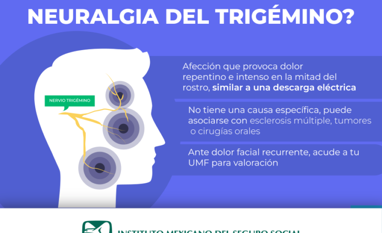 Concientiza IMSS Hidalgo Sobre Importancia de Atención Temprana de Neuralgia trigeminal