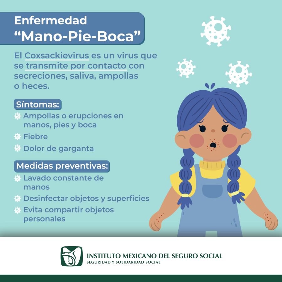 Refuerza IMSS Hidalgo Medidas Preventivas Ante Casos de Infección Por Virus Coxsackie