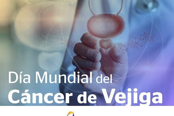 Día Mundial del Cáncer de Vejiga, Especialistas Invitan a No Ignorar Cambios a Realizar Revisiones Periódicas