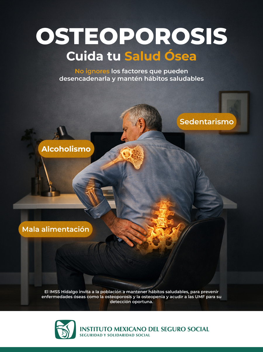 Recomienda IMSS Hidalgo Hábitos Saludables Para Cuidar La Salud Ósea