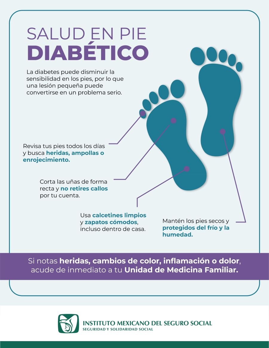 Exhorta IMSS Hidalgo a Pacientes Con Diabetes A Proteger Salud De Sus Pies