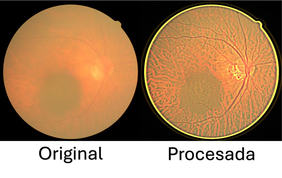 Desarrolla UPT Sistema de Bajo Costo Para Mejorar Imágenes de Retina