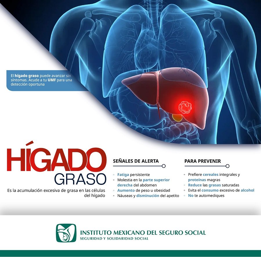 Exhorta IMSS Hidalgo a mantener hábitos saludables que ayudan a preservar salud hepática