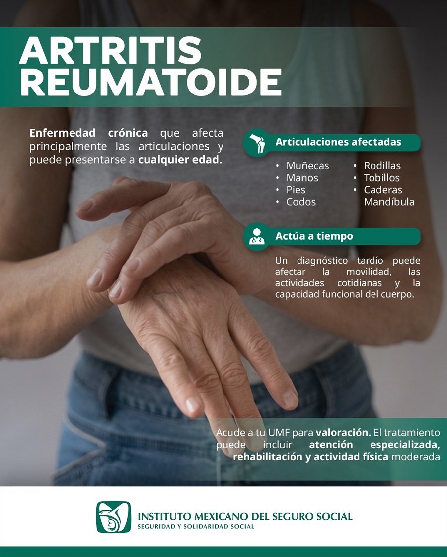 Exhorta IMSS Hidalgo a Población a Reconocer Oportunamente Síntomas de Artritis Reumatoide