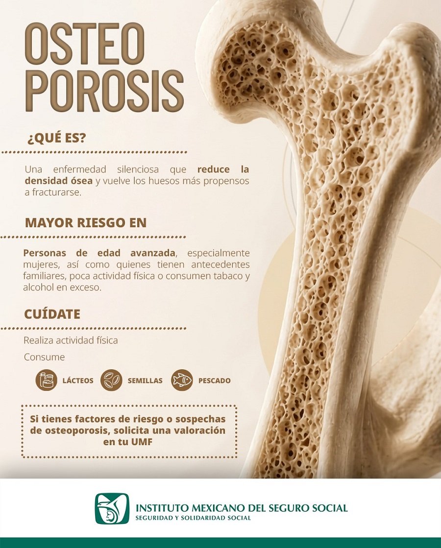 Refuerza IMSS Hidalgo acciones de prevención en Día Mundial de la Osteoporosis