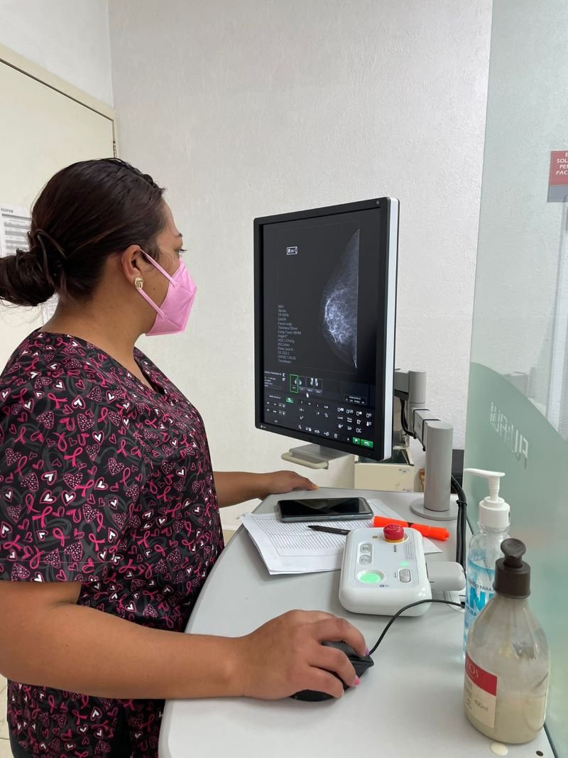 SSH Refuerza Detección del Cáncer De Mama En Hidalgo